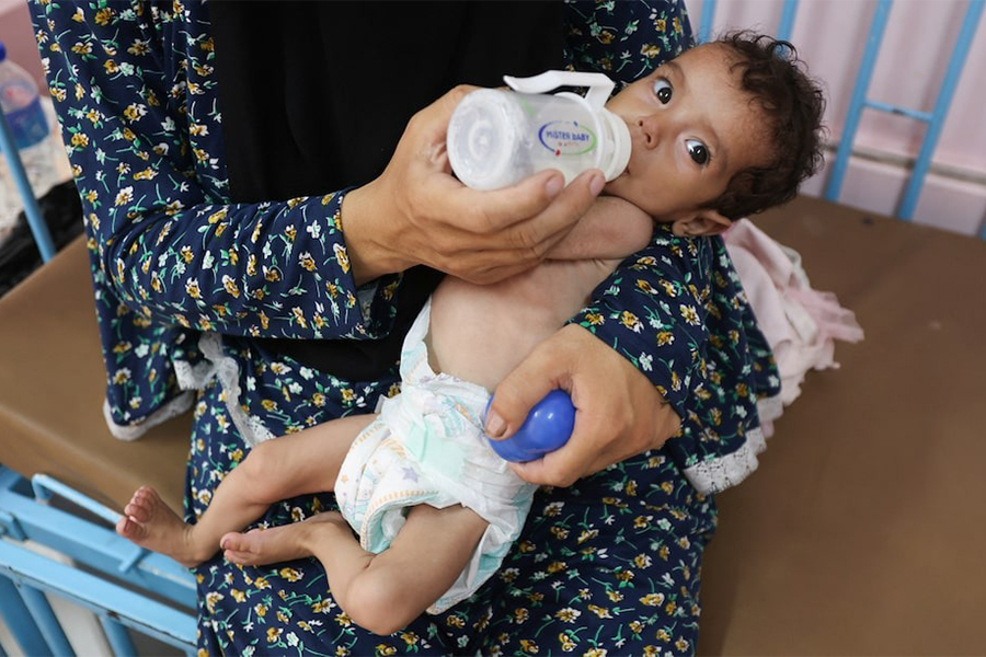 Palestinian woman Najla Abu Aya feeds her five-month-old daughter, Rama, who is malnourished, according to medics, at Nasser Hospital in Khan Younis, southern Gaza Strip on July 24, 2025 — Reuters photo
