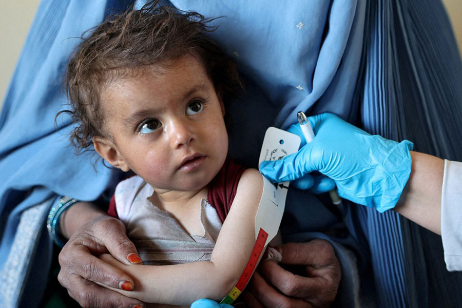 An Afghan girl looks at the doctor as he measures her upper arm at the WFP-supported Qasaba Clinic, after an increase in malnutrition cases following the return of deported Afghans, in Kabul, Afghanistan, Jan 7, 2026.