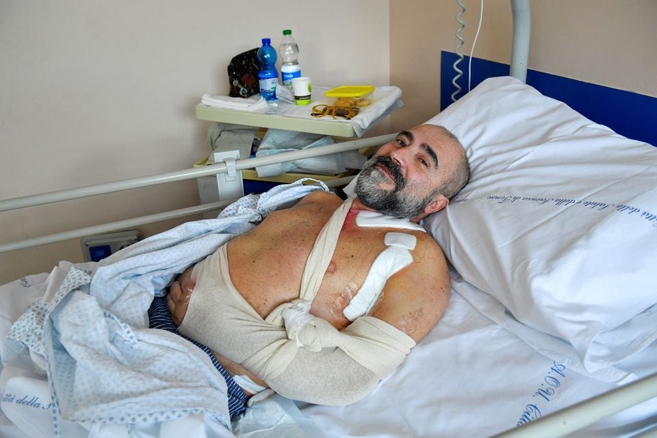 The 55-year-old healthcare worker Marcello Gaviglio, who had a nerve transplant from his amputated foot to restore his paralyzed hand, poses for a picture in his hospital bed in Turin, Italy on December 27, 2023 — Reuters photo