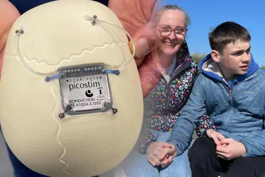 The device is screwed into the bone. Oran Knowlson (R) is seen with his mother. The photos were taken from BBC website.