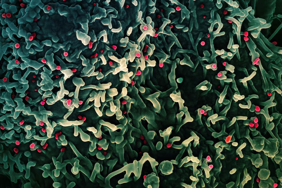 An undated colorized scanning electron micrograph of mpox virus (red) on the surface of infected VERO E6 cells (green), captured at the National Institute of Allergy and Infectious Diseases (NIAID) Integrated Research Facility (IRF) in Fort Detrick, Maryland.