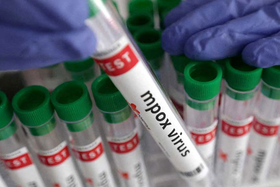 A test tube labelled “Mpox virus positive” is held in this illustration taken Aug 20, 2024.