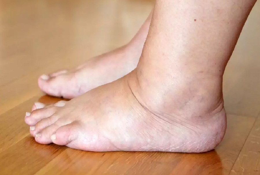 Representational image