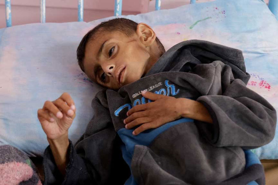 A Palestinian mother feeds her sick daughter as she receives treatment at Nasser Hospital, in Khan Younis, in the southern Gaza Strip, April 30, 2025.