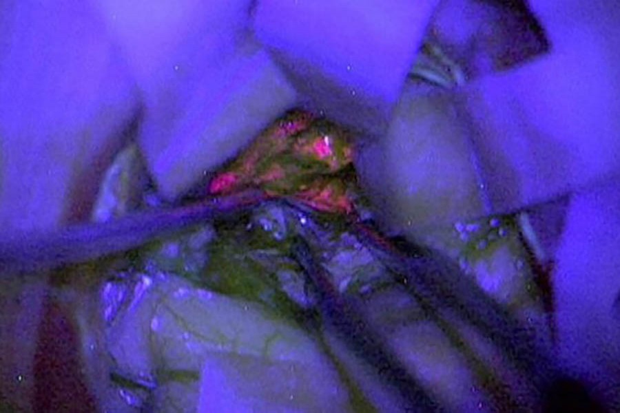 The chemical causes tumours to glow pink under UV light